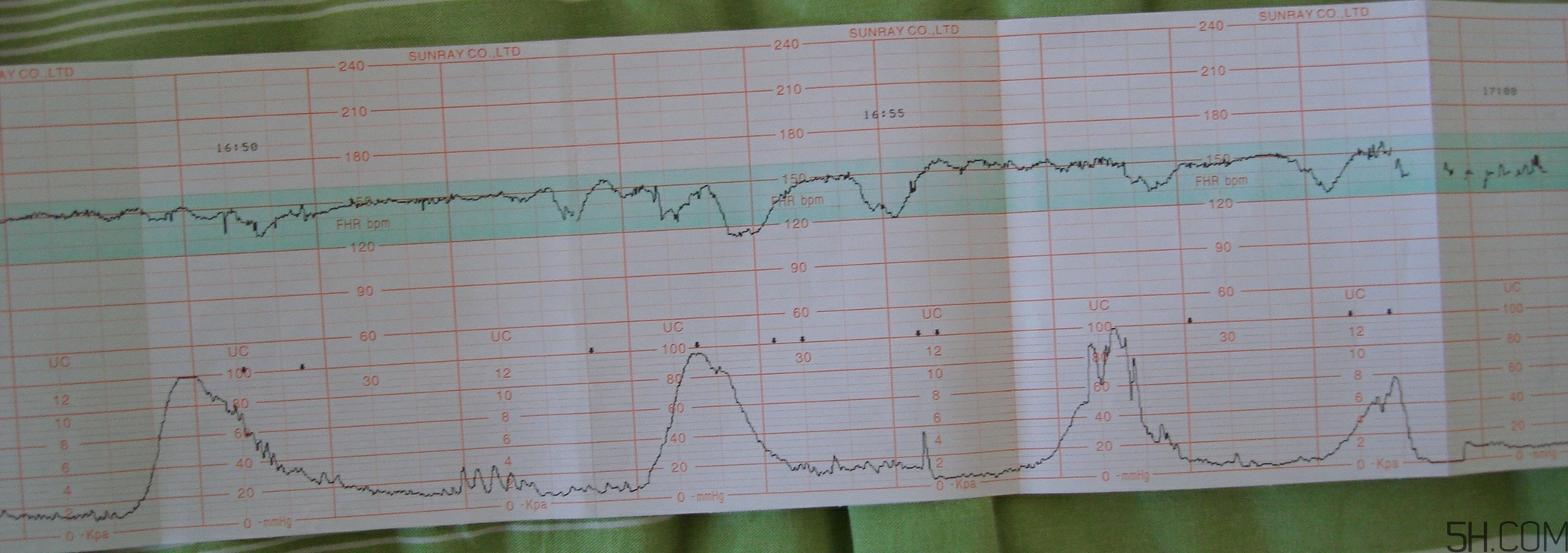 為什么要做胎心監(jiān)護？孕婦做胎心監(jiān)護有什么用？
