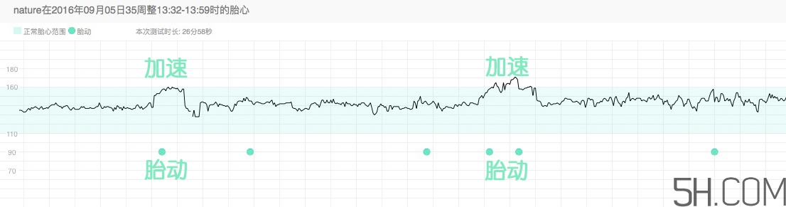 為什么要做胎心監(jiān)護？孕婦做胎心監(jiān)護有什么用？