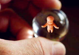 人工授精取卵子怎么?。咳斯な诰腥嗽鯓尤【?？