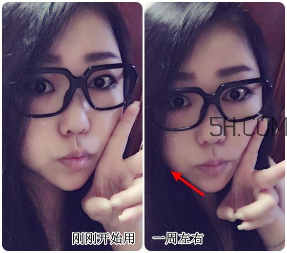 彼得羅夫娃娃臉面霜和嬌韻詩瘦臉精華哪個好? 彼得羅夫娃娃臉面霜和嬌韻詩瘦臉精華哪個好?