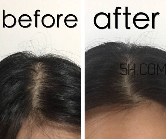 滋源洗發(fā)水多少錢一瓶_滋源洗發(fā)水價格表 滋源洗發(fā)水多少錢一瓶_滋源洗發(fā)水價格表