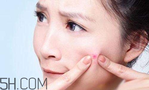 泊美祛痘系列怎么樣？泊美祛痘系列有哪些？