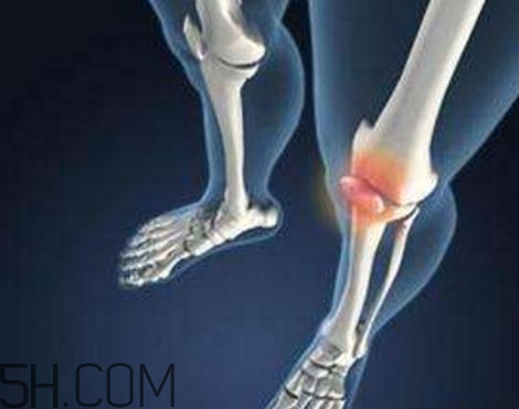 關(guān)節(jié)炎打封閉針好嗎？關(guān)節(jié)炎打封閉針有副作用嗎？