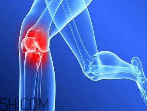 關(guān)節(jié)炎需要補(bǔ)鈣嗎？關(guān)節(jié)炎補(bǔ)鈣有用嗎？