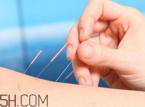 關(guān)節(jié)炎需要補(bǔ)鈣嗎？關(guān)節(jié)炎補(bǔ)鈣有用嗎？