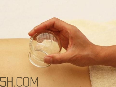 關節(jié)炎可以拔火罐嗎？關節(jié)炎拔罐管用嗎？