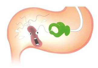 幽門螺桿菌會(huì)傳染嗎？幽門螺桿菌吃什么藥