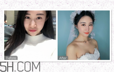 鼻頭縮小術(shù)過(guò)程圖 鼻頭縮小手術(shù)千萬(wàn)別做后悔死 鼻頭縮小術(shù)過(guò)程圖 鼻頭縮小手術(shù)千萬(wàn)別做后悔死