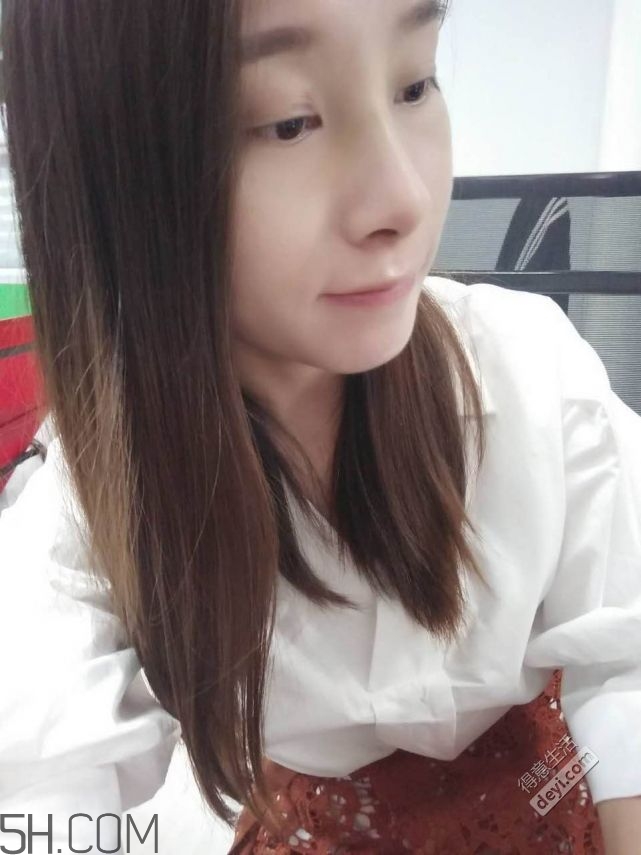 鼻頭縮小術(shù)過(guò)程圖 鼻頭縮小手術(shù)千萬(wàn)別做后悔死 鼻頭縮小術(shù)過(guò)程圖 鼻頭縮小手術(shù)千萬(wàn)別做后悔死