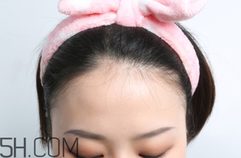 發(fā)際線不好看怎么修飾 完美解決6種發(fā)際線問(wèn)題 發(fā)際線不好看怎么修飾 完美解決6種發(fā)際線問(wèn)題