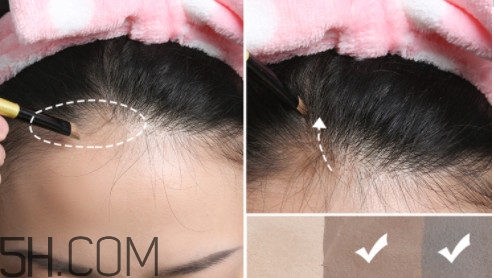 發(fā)際線不好看怎么修飾 完美解決6種發(fā)際線問(wèn)題 發(fā)際線不好看怎么修飾 完美解決6種發(fā)際線問(wèn)題