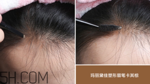 發(fā)際線不好看怎么修飾 完美解決6種發(fā)際線問(wèn)題 發(fā)際線不好看怎么修飾 完美解決6種發(fā)際線問(wèn)題