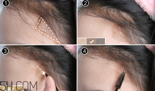 發(fā)際線不好看怎么修飾 完美解決6種發(fā)際線問(wèn)題 發(fā)際線不好看怎么修飾 完美解決6種發(fā)際線問(wèn)題