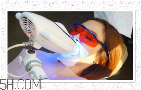 超聲波洗牙可以美白牙齒嗎？超聲波洗牙多少錢一次？