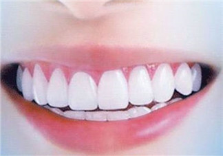 怎么用牙線？預防牙齒黃的方法