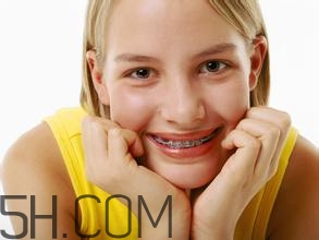 補(bǔ)牙需要帶牙套嗎？補(bǔ)牙后要裝牙套多少錢？