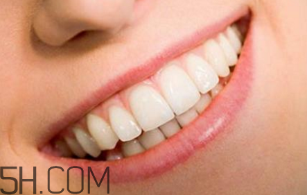 牙齒做貼面多少錢一顆？烤瓷牙可以取下來嗎？