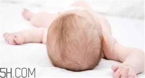 寶寶濕疹媽媽吃哪些食物比較好？寶寶秋冬脫發(fā)要怎么辦？