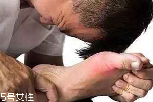 痛風(fēng)可以治愈嗎？無法治愈但能控制