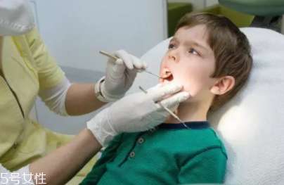 牙結(jié)石能自動(dòng)脫落嗎？除了洗牙別無他法