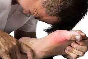 痛風(fēng)可以治愈嗎？無法治愈但能控制