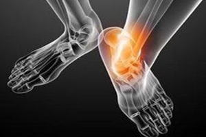 痛風(fēng)跟飲食有關(guān)？痛風(fēng)更多與遺傳有關(guān)