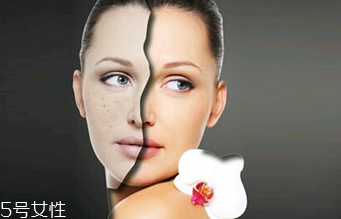 點痣的危害有哪些？激光點痣后的飲食禁忌