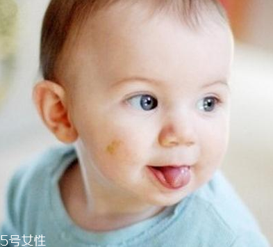 胎記怎么去除？胎記有遺傳的可能