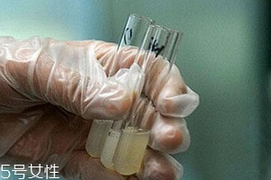 捐精有什么危害？專家稱沒有危害