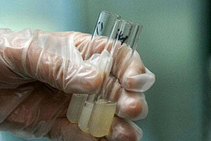 捐精有什么危害？專家稱沒(méi)有危害