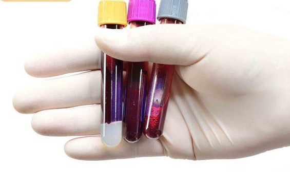 貧血一定是缺鐵嗎 貧血不等于缺鐵 貧血一定是缺鐵嗎 貧血不等于缺鐵