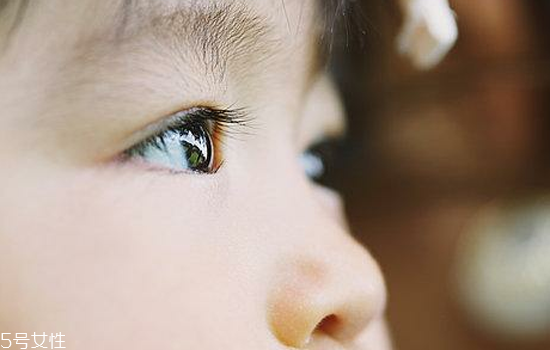 寶寶眼睛一大一小怎么回事啊 需警惕4種可能 寶寶眼睛一大一小怎么回事啊 需警惕4種可能