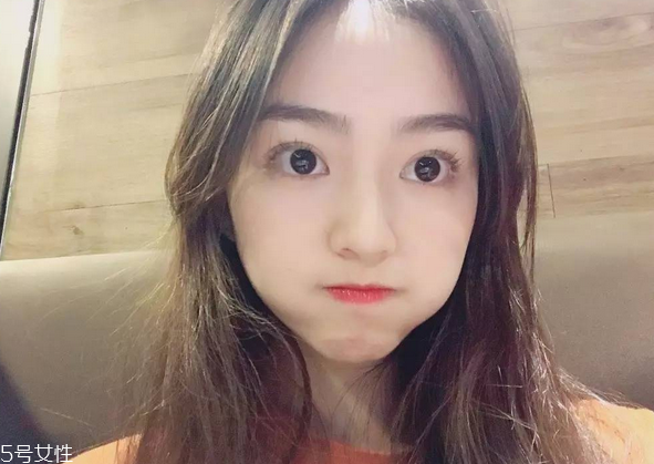 割雙眼皮要注意什么？割雙眼皮充血是正?，F(xiàn)象