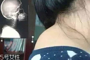 富貴包是什么??？姿態(tài)優(yōu)美少犯病