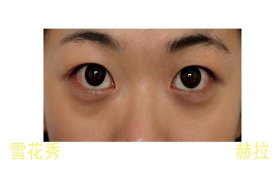 雪花秀氣墊和赫拉氣墊的區(qū)別 適合不適合你最重要 雪花秀氣墊和赫拉氣墊的區(qū)別 適合不適合你最重要