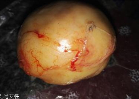 鴨寶多少錢(qián)一克 鑒定方法 鴨寶多少錢(qián)一克 鑒定方法