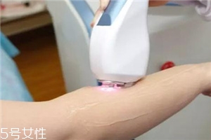 脫毛儀可以脫發(fā)際線嗎？脫了還會(huì)再長