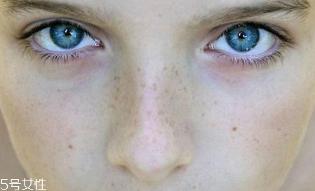 去黑頭哪個(gè)牌子好 去黑頭最好的面膜2022 去黑頭哪個(gè)牌子好 去黑頭最好的面膜2022