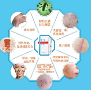 芙清凝膠的功效和副作用 芙清凝膠的功效和副作用