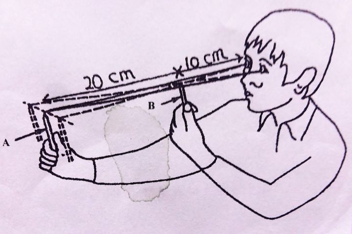 斜視是什么意思 斜視帶來生活的影響 斜視是什么意思 斜視帶來生活的影響