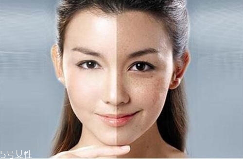 刷酸時(shí)要注意什么 刷酸去閉口操作指南 刷酸時(shí)要注意什么 刷酸去閉口操作指南