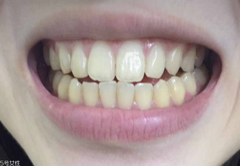 中華美白牙膏真的能美白嗎 中華美白牙膏評(píng)測(cè) 中華美白牙膏真的能美白嗎 中華美白牙膏評(píng)測(cè)