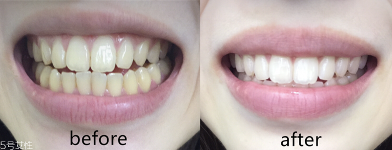 中華美白牙膏真的能美白嗎 中華美白牙膏評(píng)測(cè) 中華美白牙膏真的能美白嗎 中華美白牙膏評(píng)測(cè)