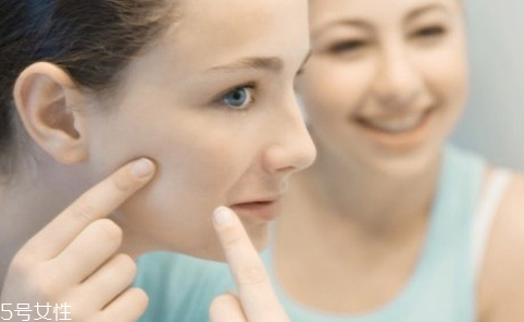 如何正確擠痘痘 正確處理痘痘的方法 如何正確擠痘痘 正確處理痘痘的方法