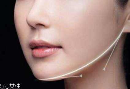 粉毒瘦臉針能維持多久？粉毒瘦臉針能保持多長(zhǎng)時(shí)間