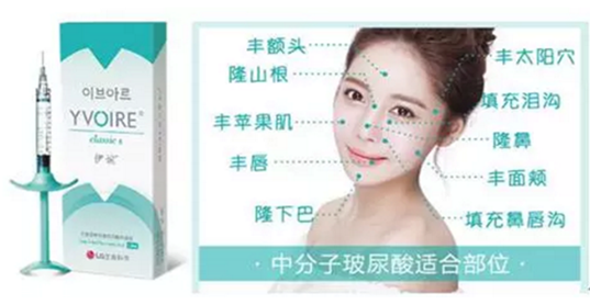 伊婉玻尿酸有幾個(gè)型號(hào) 伊婉c型和v型的區(qū)別 伊婉玻尿酸有幾個(gè)型號(hào) 伊婉c型和v型的區(qū)別