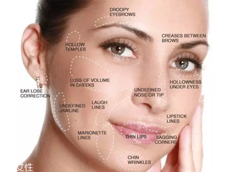 伊婉艾莉薇哪個好隆鼻 伊婉玻尿酸打鼻子好嗎 伊婉艾莉薇哪個好隆鼻 伊婉玻尿酸打鼻子好嗎