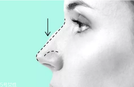 伊婉c是中分子嗎 伊婉玻尿酸真假對比圖片 伊婉c是中分子嗎 伊婉玻尿酸真假對比圖片