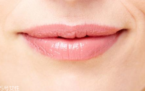 嘴唇長皺紋怎么預防 嘴唇長皺紋的預防方法 嘴唇長皺紋怎么預防 嘴唇長皺紋的預防方法