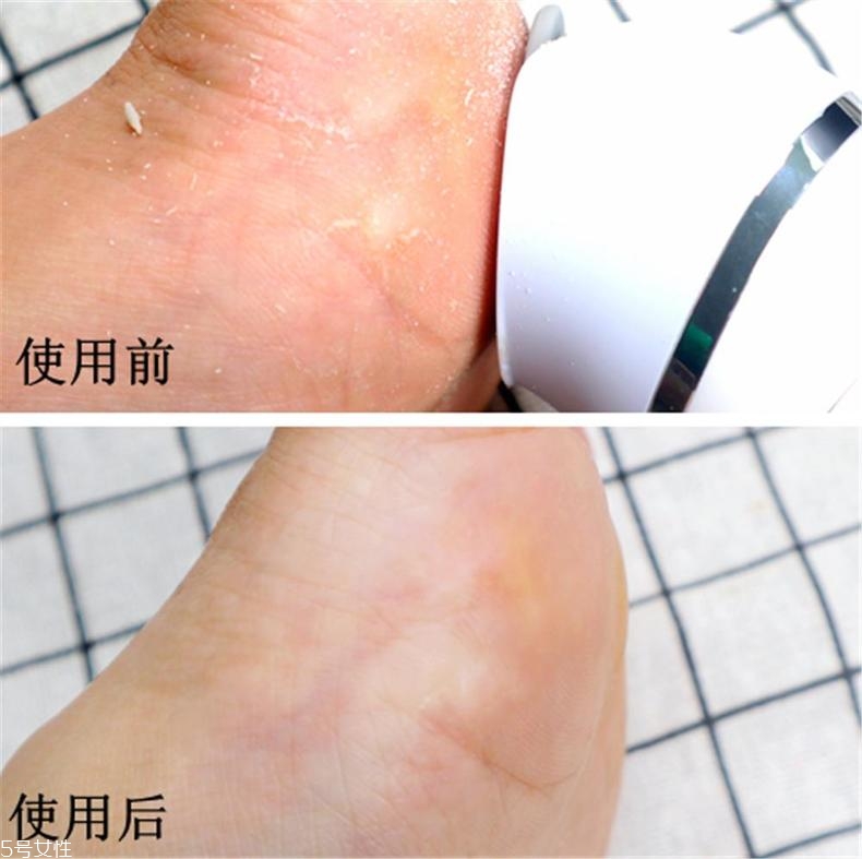 飛利浦美足儀怎么樣 飛利浦美足儀好用嗎 飛利浦美足儀怎么樣 飛利浦美足儀好用嗎